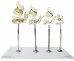 Dentes - Desenvolvimento da Dentição