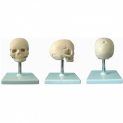 Esqueletos - Crânio Fetal