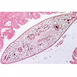 Lâminas Preparadas - Parasitologia 30pçs/cx